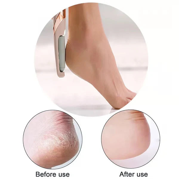 LS Mart™ Electric Callus Remover